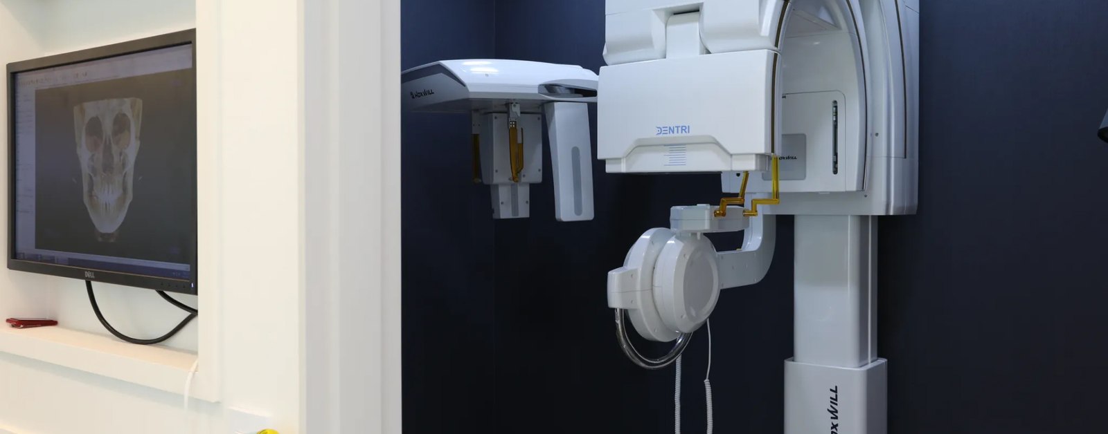 연세반트교정치과의 파노라마 X-ray 장비 모습입니다.