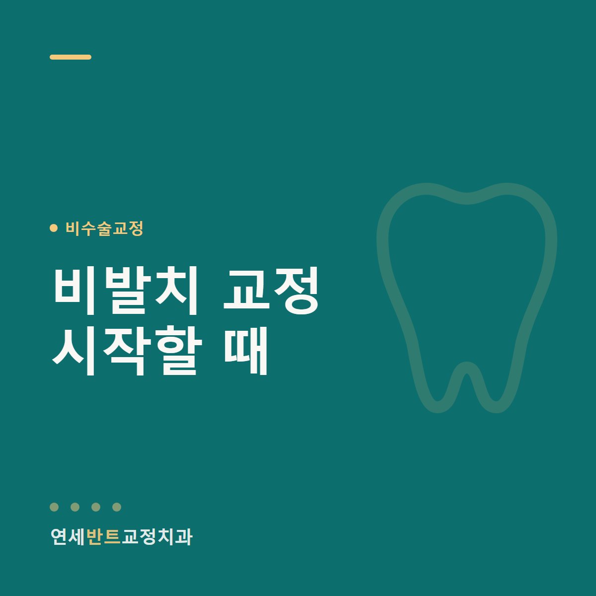비발치 교정 시작할