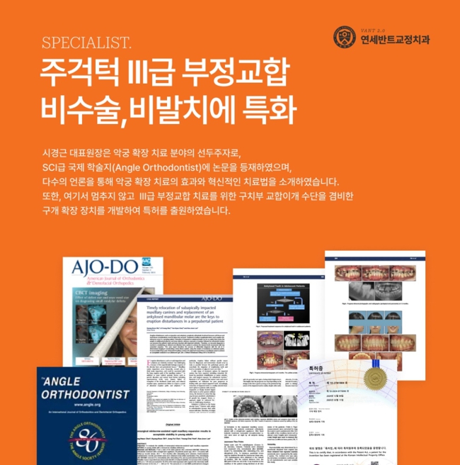 비발치 교정 안내