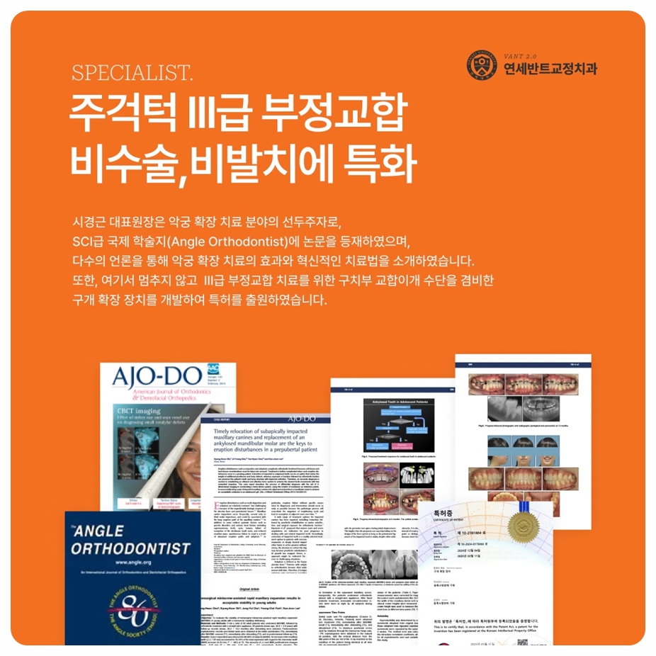 구월동교정치과 선택 전 확인사항