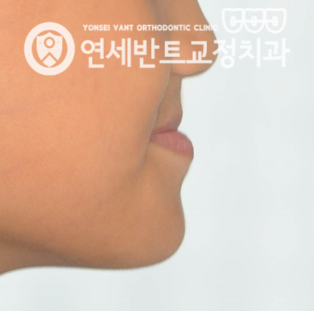 옆모습 사진