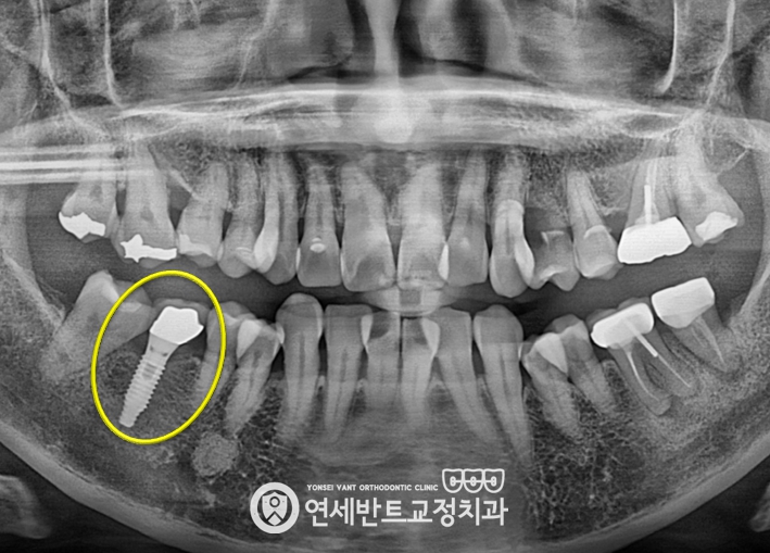 파노라마 촬영