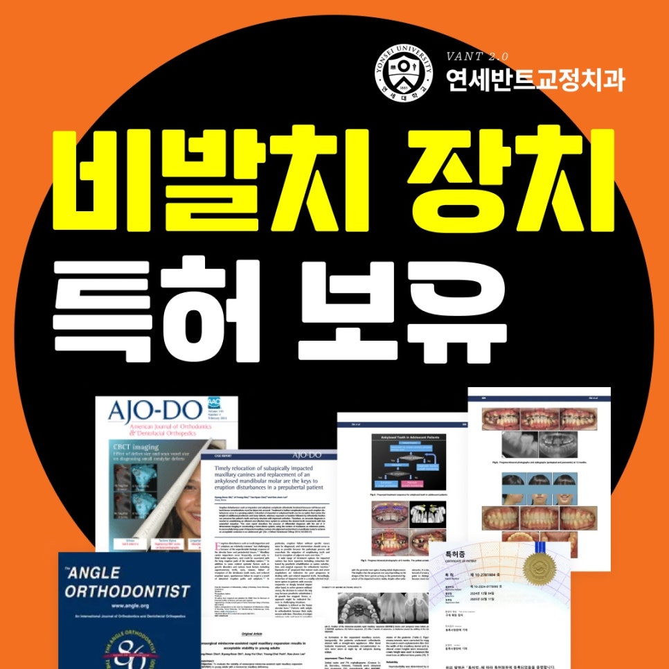 인천악궁확장교정 수술 없이 균형을 되찾는 방법
