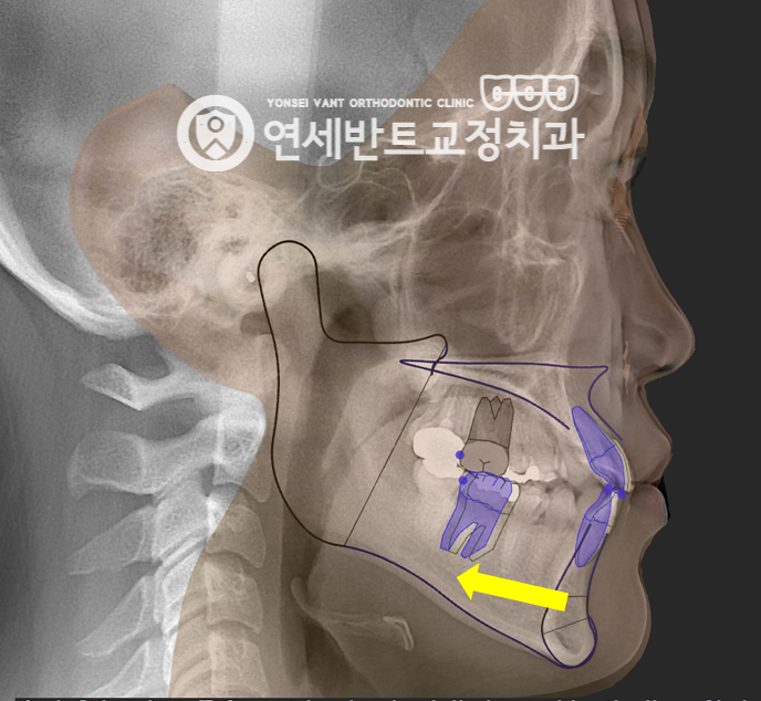 턱 구조 도해