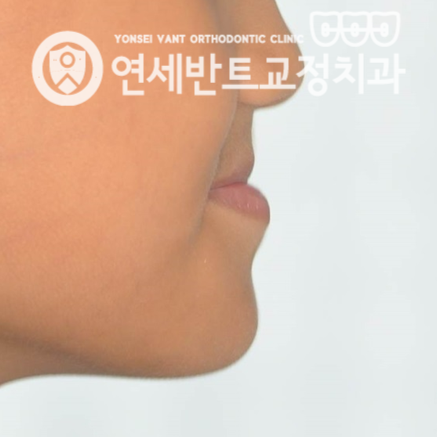 옆모습 사진