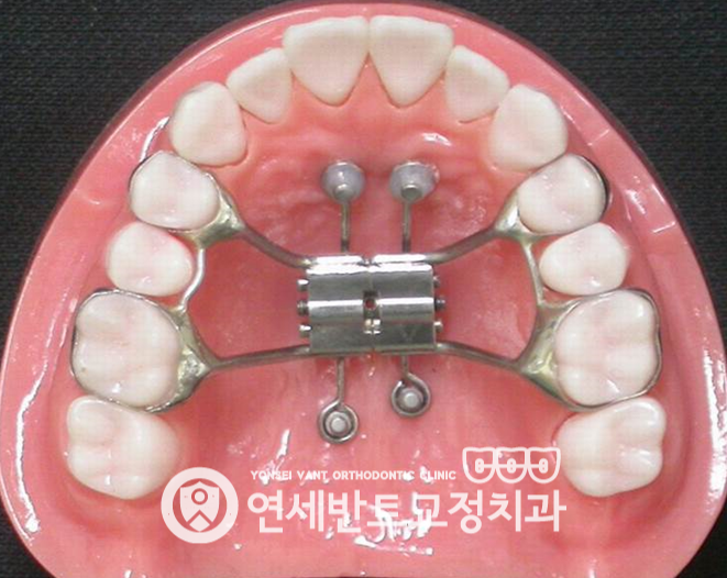 확장장치 모형