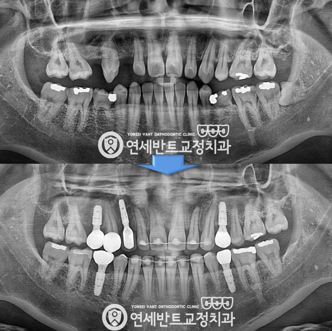 파노라마 촬영
