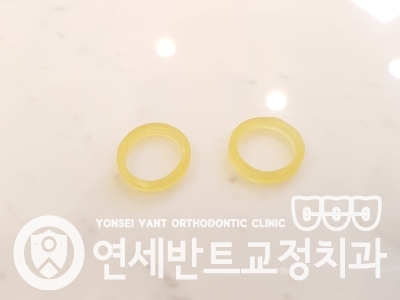 교정용 고무링