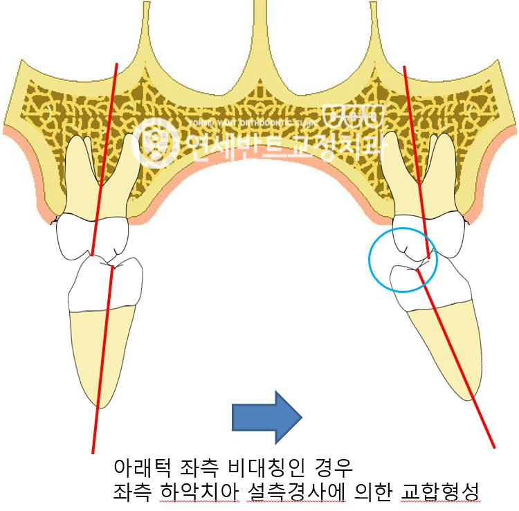 치아 단면 도해