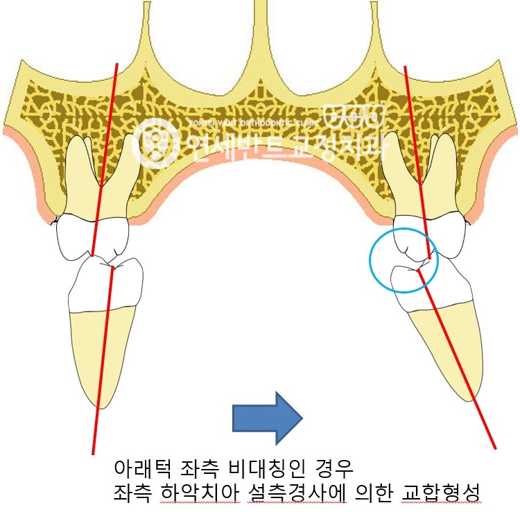 치아 단면 도해