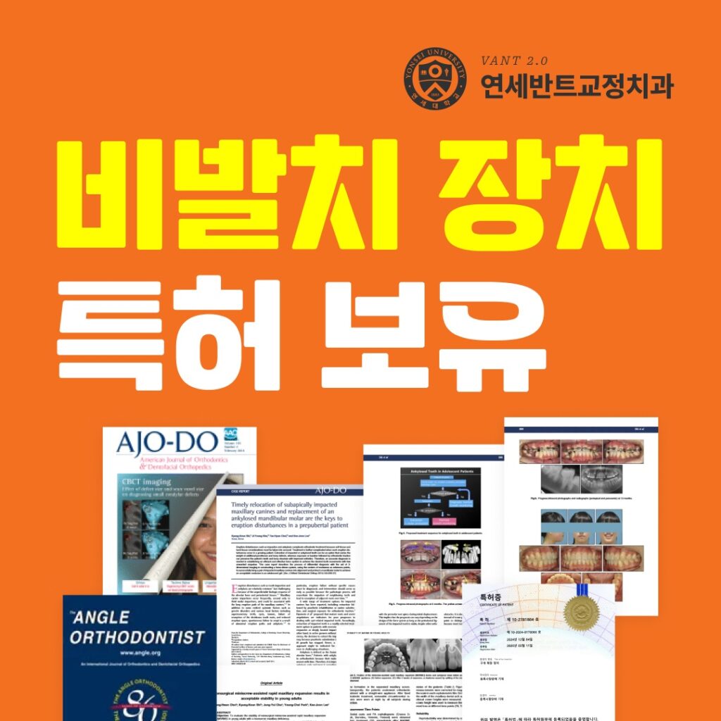 계양구에서 비수술 인천 주걱턱교정이 가능할까