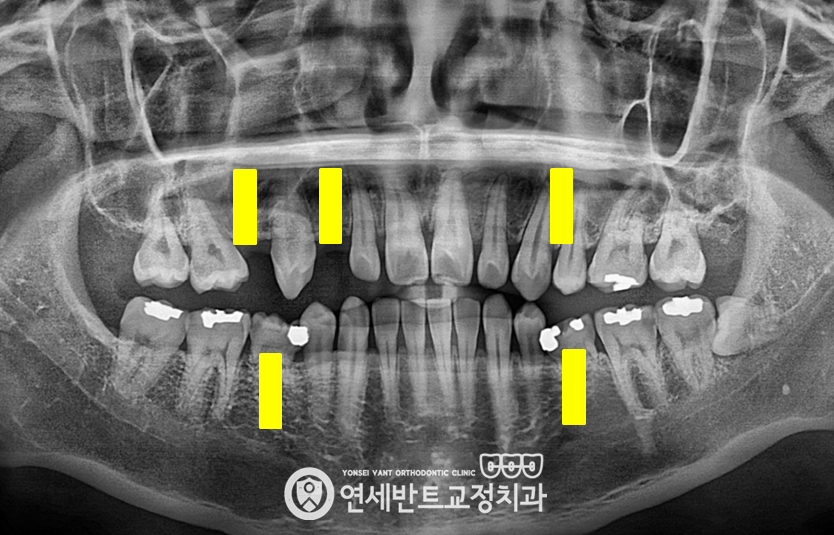 파노라마 촬영