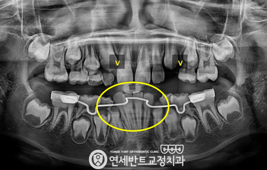 파노라마 촬영