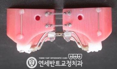 확장장치 모형