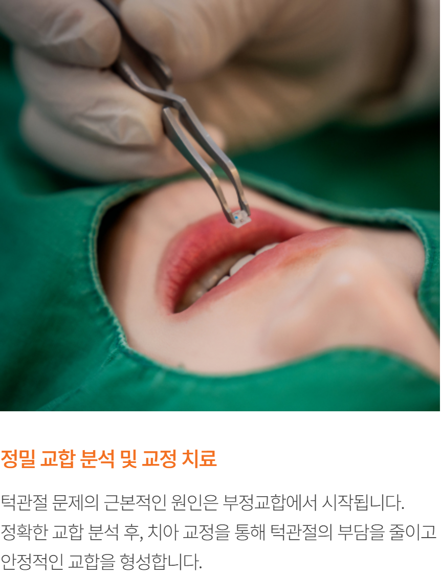 정밀교합 분석안내