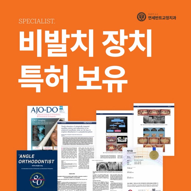 과개교합을 인천 비발치교정으로 접근하려면